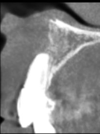 顔が腫れていたい、他院で残せないと言われた
