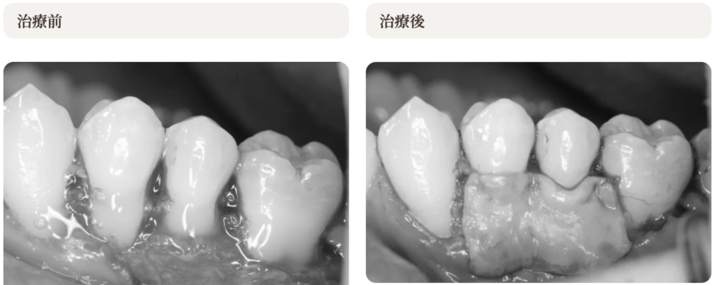 術前術後