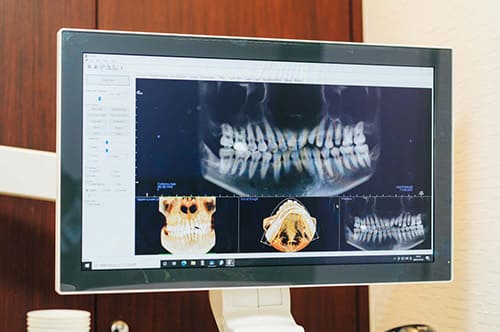 CT、デジタルシュミレーションを活用した精密診断