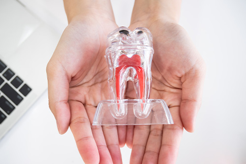 奥歯の歯周病が心配・根分岐部（分岐部病変）があると言われた