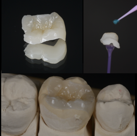 セラミック治療で後悔しないために。歯科医院選びの重要な“セットのこだわり”とは？