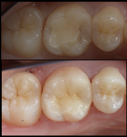 セラミック治療で後悔しないために。歯科医院選びの重要な“セットのこだわり”とは？